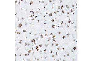 Immunohistochemistry of paraffin-embedded rat liver using NFKB2 Antibody. (NFKB2 抗体  (AA 690-899))