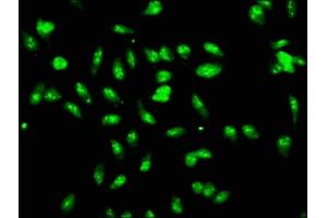 Immunofluorescence staining of Hela cells with ABIN7147315 at 1:166, counter-stained with DAPI. (LYAR 抗体  (AA 1-379))