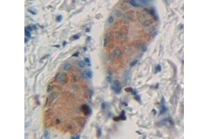 #VALUE! (Cytokeratin 28 抗体  (AA 1-462))