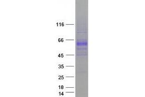 Western Blotting (WB) image for Bone Morphogenetic Protein 6 (BMP6) protein (Myc-DYKDDDDK Tag) (ABIN2715307)