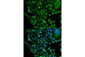 Immunofluorescence analysis of HeLa cell using PSMD10 antibody. (PSMD10 抗体  (AA 1-226))