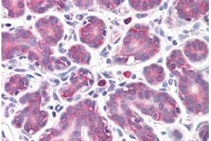 Human Breast: Formalin-Fixed, Paraffin-Embedded (FFPE) (GPR32 抗体  (AA 1-15))