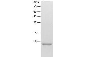 Western Blotting (WB) image for Tumor Necrosis Factor Receptor Superfamily, Member 12A (TNFRSF12A) (AA 28-80) protein (His tag) (ABIN7125548) (TNFRSF12A Protein (AA 28-80) (His tag))