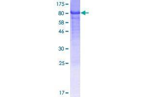 TOR1AIP2 Protein (AA 1-470) (GST tag)