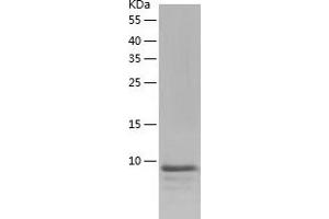 Western Blotting (WB) image for Family with Sequence Similarity 19 (Chemokine (C-C Motif)-Like), Member A2 (FAM19A2) (AA 31-131) protein (His tag) (ABIN7122876) (FAM19A2 Protein (AA 31-131) (His tag))