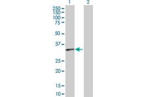 Western Blotting (WB) image for anti-Prostaglandin D2 Receptor (PTGDR) (AA 1-359) antibody (ABIN519442)