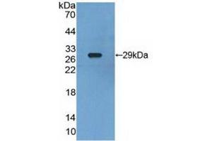 Figure. (Retinoid X Receptor gamma 抗体  (AA 12-220))