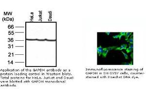 Image no. 1 for anti-Glyceraldehyde-3-Phosphate Dehydrogenase (GAPDH) antibody (ABIN274251) (GAPDH 抗体)