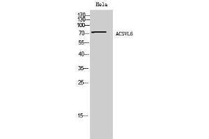 Western Blotting (WB) image for anti-Solute Carrier Family 27 (Fatty Acid Transporter), Member 5 (SLC27A5) (Internal Region) antibody (ABIN3183156) (SLC27A5 抗体  (Internal Region))
