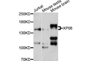 Western blot analysis of extracts of various cell lines, using XPO6 antibody (ABIN4905638) at 1:1000 dilution. (Exportin 6 抗体)