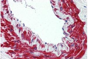 Immunohistochemistry (IHC) image for anti-Transient Receptor Potential Cation Channel, Subfamily M, Member 8 (TRPM8) (N-Term) antibody (ABIN960829)