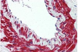 Anti-TRPM8 antibody  ABIN960829 IHC staining of human lung, vessel. (TRPM8 抗体  (N-Term))