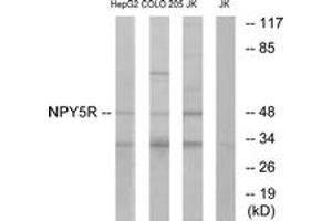 Western blot analysis of extracts from COLO/Jurkat/HepG2 cells, using NPY5R Antibody. (NPY5R 抗体  (AA 221-270))