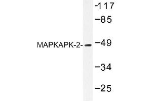 Image no. 1 for anti-Mitogen-Activated Protein Kinase-Activated Protein Kinase 2 (MAPKAPK2) antibody (ABIN272118) (MAPKAP Kinase 2 抗体)