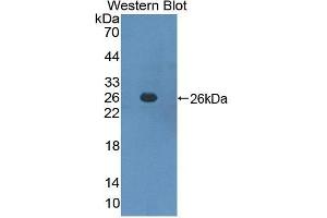 Western Blotting (WB) image for anti-Suppressor of Cytokine Signaling 3 (SOCS3) (AA 1-225) antibody (ABIN1078552) (SOCS3 抗体  (AA 1-225))