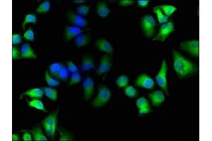 Immunofluorescence staining of Hela cells with ABIN7141990 at 1:100, counter-stained with DAPI.