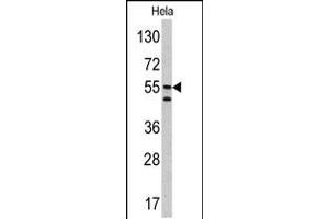 Western blot analysis of CA9 antibody in Hela cell line lysates (35ug/lane) (CA9 抗体  (AA 113-143))