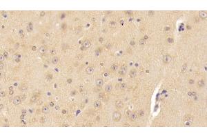 Immunohistochemistry (IHC) image for anti-Cortistatin (CORT) (AA 410-612) antibody (ABIN7444580)