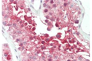 Immunohistochemistry (IHC) image for anti-RuvB-Like 2 (E. Coli) (RUVBL2) (N-Term) antibody (ABIN2779601)