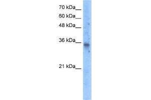 Western Blotting (WB) image for anti-Solute Carrier Family 25 (Mitochondrial Carrier, Graves Disease Autoantigen), Member 16 (SLC25A16) (N-Term) antibody (ABIN2781727)