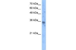 WB Suggested Anti-SLC25A16 Antibody Titration:  5. (SLC25A16 抗体  (N-Term))