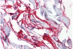 Human Colon, connective tissue: Formalin-Fixed, Paraffin-Embedded (FFPE) (Aquaporin 8 抗体  (AA 1-255))