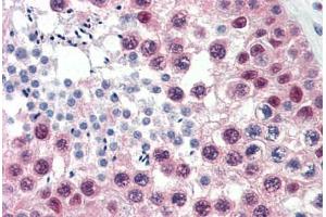 Human Testis (formalin-fixed, paraffin-embedded) stained with CUL1 antibody ABIN337174 at 10 ug/ml followed by biotinylated anti-mouse IgG secondary antibody ABIN481714, alkaline phosphatase-streptavidin and chromogen. (Cullin 1 抗体  (C-Term))