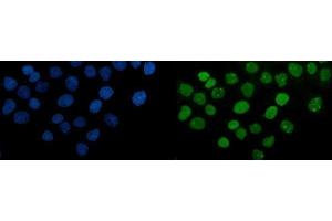 anti-Poly (ADP-Ribose) Polymerase 1 (PARP1) (AA 670-858) antibody