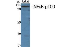 Western Blot (WB) analysis of specific cells using NFkappaB-p100 Polyclonal Antibody. (NFKB2 抗体  (Thr160))