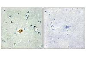 Immunohistochemistry analysis of paraffin-embedded human brain tissue using SOX8/9/17/18 antibody. (SOX8 抗体  (C-Term))
