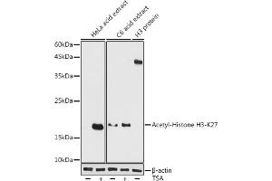 Western blot analysis of extracts of various cell lines, using Acetyl-Histone H3-K27 antibody (ABIN7267738) at 1:1000 dilution.