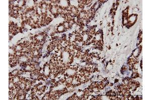 Immunostaining (ISt) image for anti-X-Ray Repair Complementing Defective Repair in Chinese Hamster Cells 6 (XRCC6) (AA 1-609) antibody (ABIN560973)