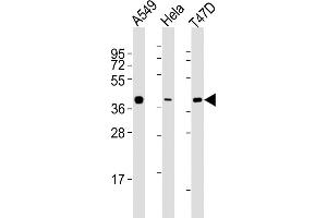 All lanes : Anti-ERCC1 Antibody (C-term) at 1:2000 dilution Lane 1: A549 whole cell lysates Lane 2: Hela whole cell lysates Lane 3: T47D whole cell lysates Lysates/proteins at 20 μg per lane. (ERCC1 抗体  (C-Term))