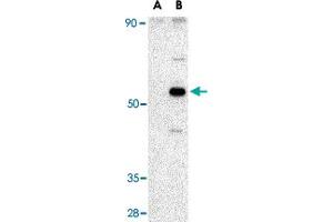 Western blot analysis of AVEN in Raji cell lysate with AVEN polyclonal antibody  at 1 ug/mL in (A) the presence and (B) the absence of blocking peptide. (AVEN 抗体  (C-Term))