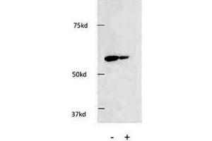 Western blot testing of HDAC1 antibody and HEK293 cells. (HDAC1 抗体  (AA 449-482))