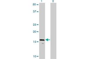 Western Blot analysis of AGTRAP expression in transfected 293T cell line by AGTRAP monoclonal antibody (M02), clone 1G2. (AGTRAP 抗体  (AA 108-159))
