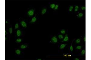 Immunofluorescence (IF) image for anti-Cullin-Associated and Neddylation-Dissociated 1 (CAND1) (AA 1-100) antibody (ABIN565932)