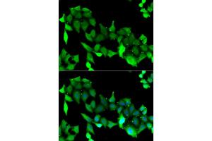 Immunofluorescence analysis of A549 cells using GRK6 antibody. (GRK6 抗体)