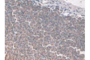 IHC-P analysis of Mouse Stomach Tissue, with DAB staining. (FAP 抗体  (AA 542-761))