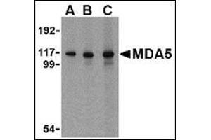 Western blot analysis of MDA5 in Daudi cell lysate with AP30553PU-N MDA5 antibody at 1 µg/ml (A), 2 µg/ml (B) and 4 μg/ml (C). (IFIH1 抗体  (C-Term))