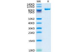SDS-PAGE (SDS) image for Fibroblast Activation Protein, alpha (FAP) (AA 26-760) protein (His-Avi Tag,Biotin) (ABIN7274582)