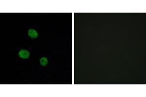 Peptide - +Immunofluorescence analysis of MCF-7 cells, using hnRNP M antibody. (HNRNPM 抗体)