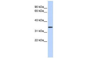 CCDC90A antibody used at 1 ug/ml to detect target protein. (CCDC90A 抗体  (Middle Region))