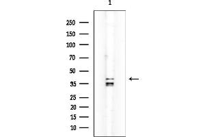 anti-Dual Specificity Phosphatase 9 (DUSP9) (Internal Region) antibody