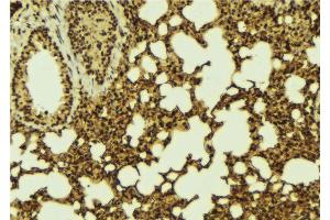 ABIN6267096 at 1/100 staining Mouse lung tissue by IHC-P. (BCL9L 抗体  (pSer915))