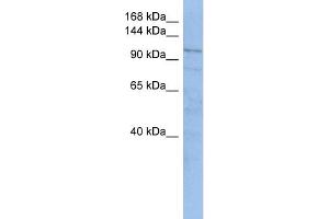 WB Suggested Anti-TRAK1  Antibody Titration: 0. (TRAK1 抗体  (Middle Region))