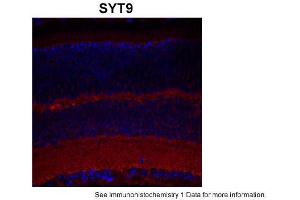 Sample Type: complete mouse retina sectionsRed: PrimaryBlue: DAPIPrimary Dilution: 1:200Secondary Antibody: Goat anti-Rabbit AF568 IgG(H+L)Secondary Dilution: 1:200Image Submitted by: David ZenisekYale University (SYT9 抗体  (Middle Region))