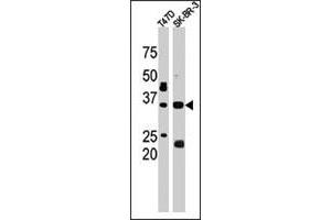 The ICMT polyclonal antibody  is used in Western blot to detect ICMT in T-47D (left) and SK-BR-3 (right) cell lysates. (ICMT 抗体  (C-Term))