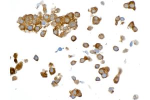 Immunocytochemistry (ICC) image for anti-Glyceraldehyde-3-Phosphate Dehydrogenase (GAPDH) (AA 225-275) antibody (ABIN7449428) (Recombinant GAPDH 抗体  (AA 225-275))