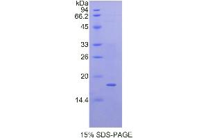 SDS-PAGE (SDS) image for Quiescin Q6 Sulfhydryl Oxidase 1 (QSOX1) (AA 37-181) protein (His tag) (ABIN1878308) (QSOX1 Protein (AA 37-181) (His tag))